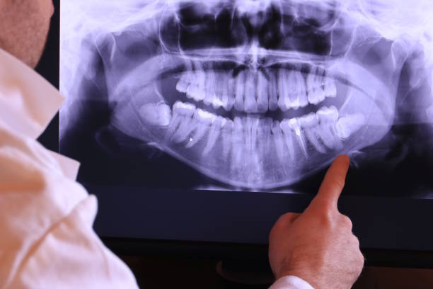 Best Emergency Tooth Extraction in Avenel, NJ